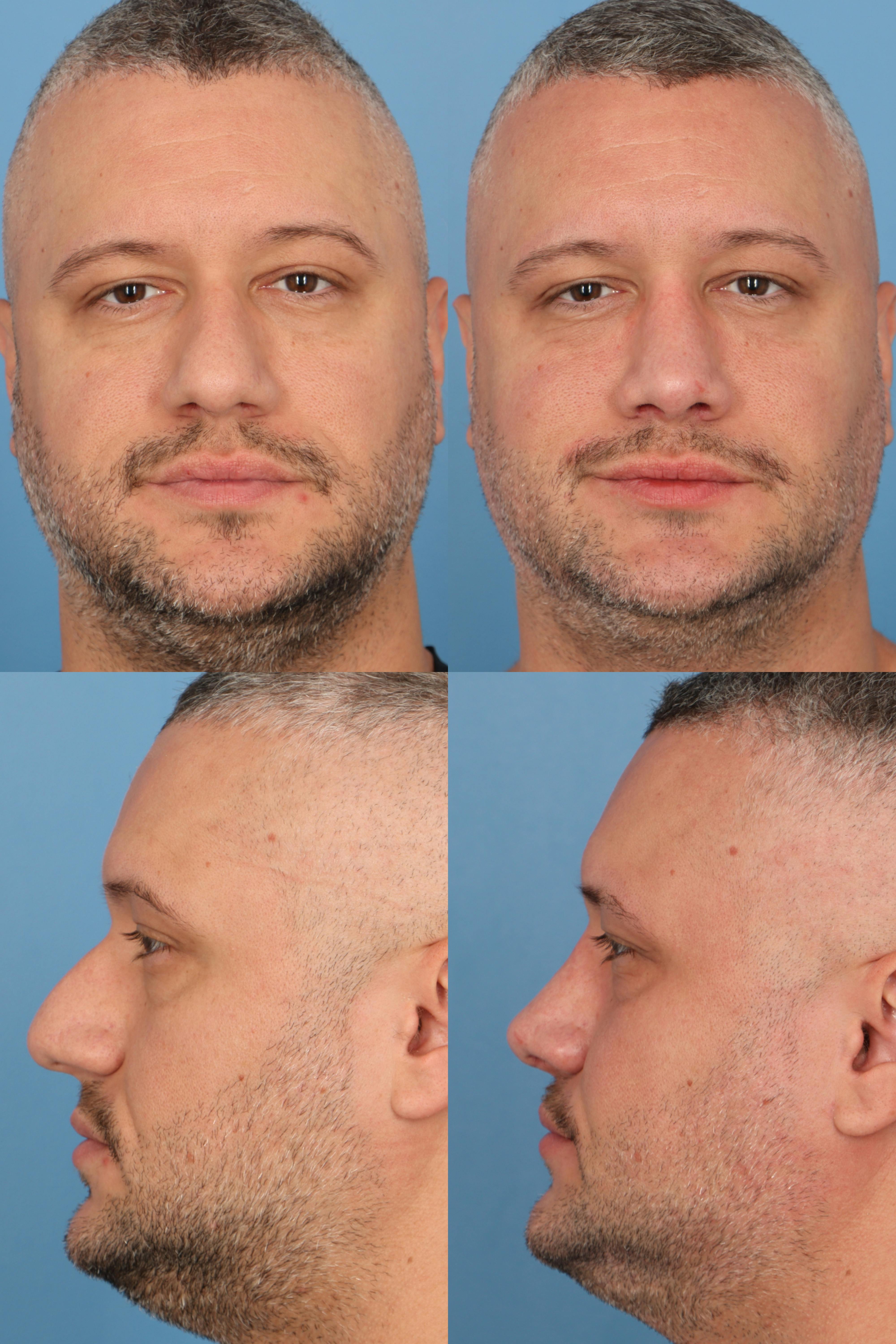 procedure