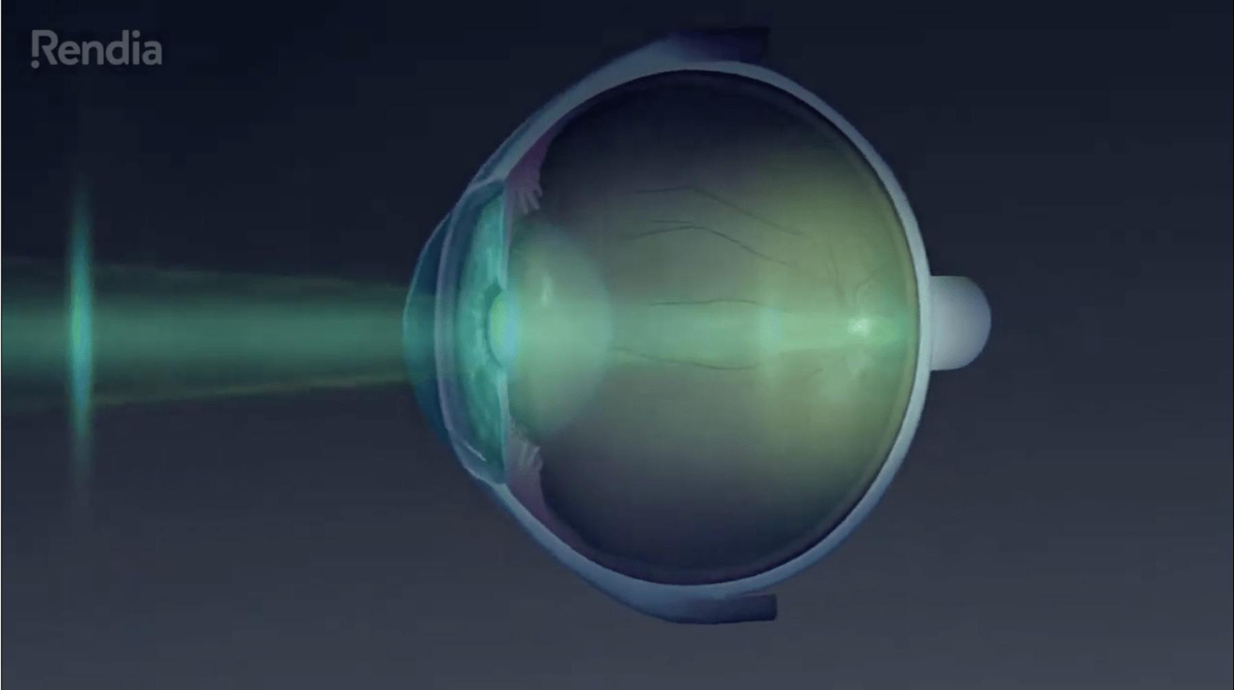 Waring Vision