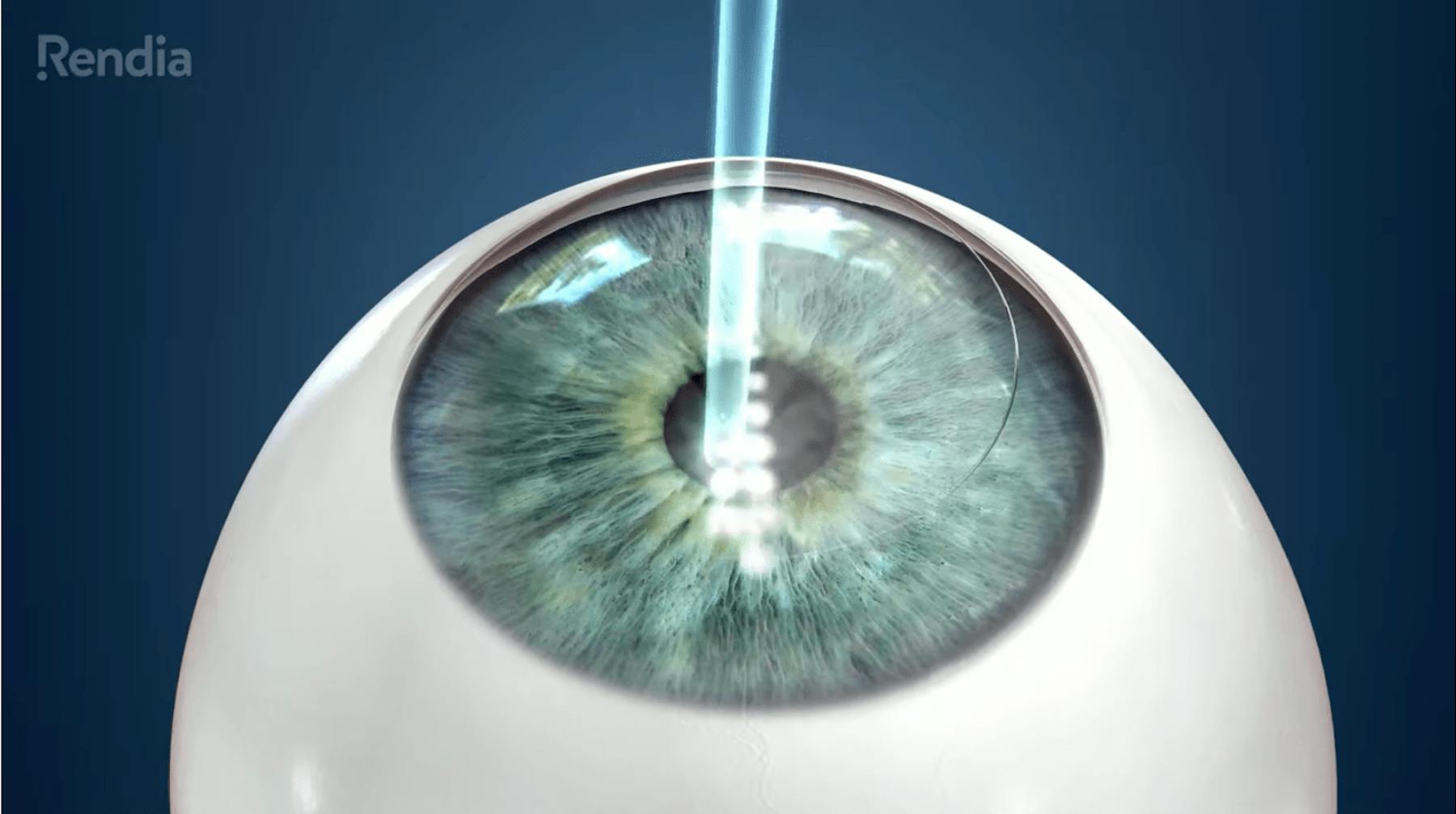 Waring Vision