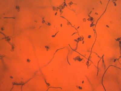 Entomopathogenic Fungi in agriculture: natural enemies of insect pests