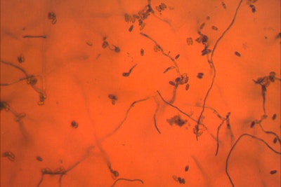 Entomopathogenic Fungi in agriculture: natural enemies of insect pests