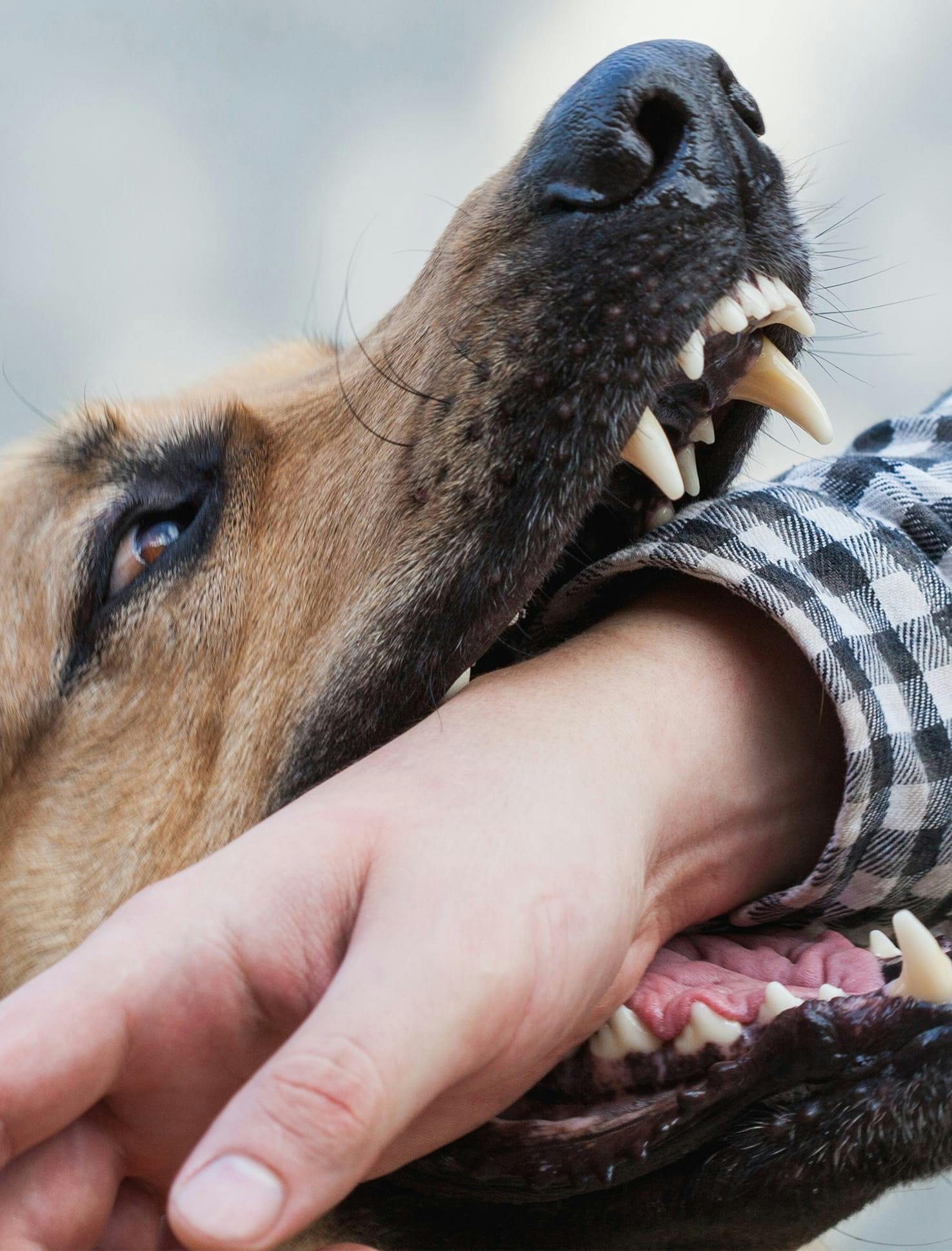 Hand getting bitten by dog