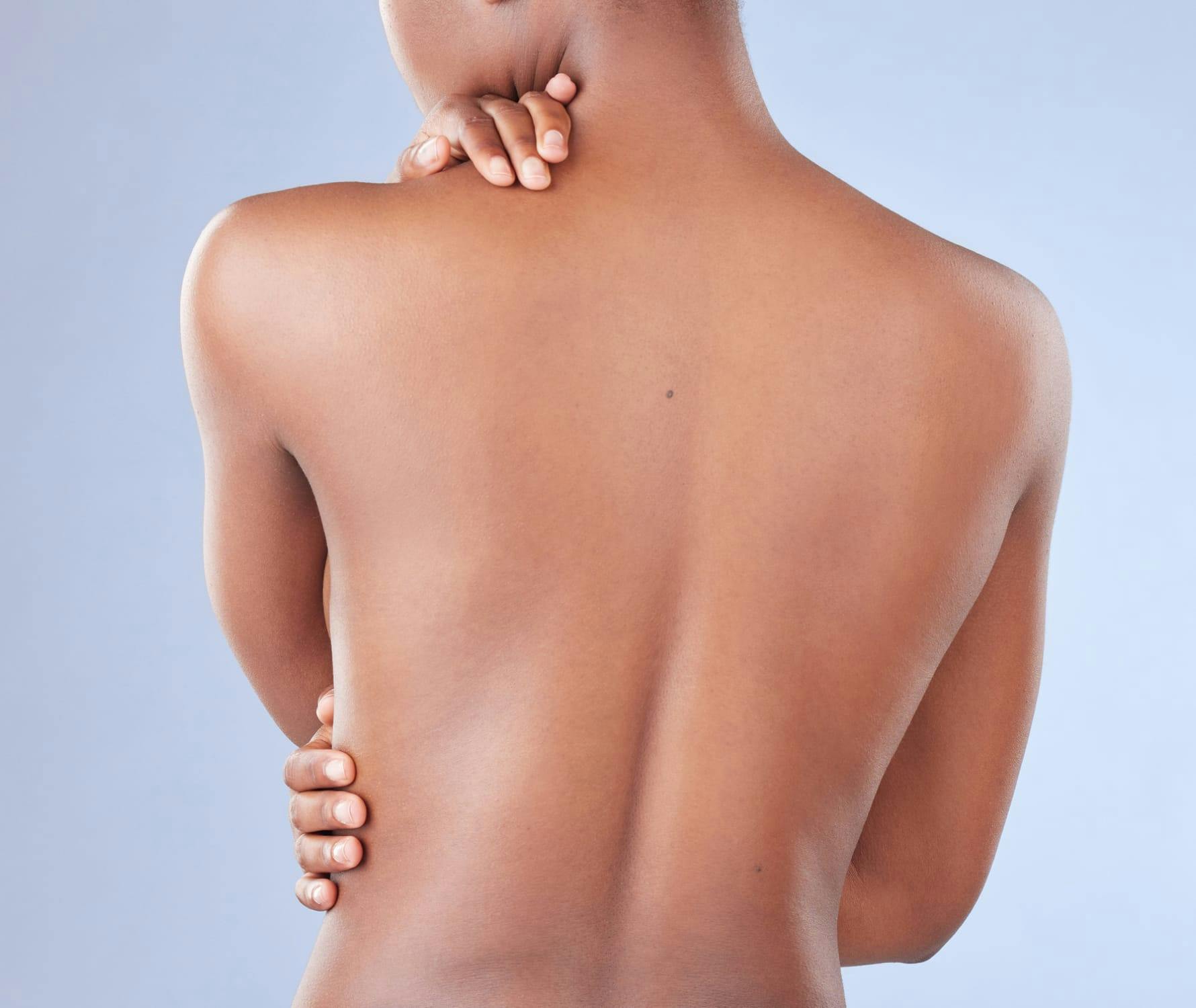 A womans bare back