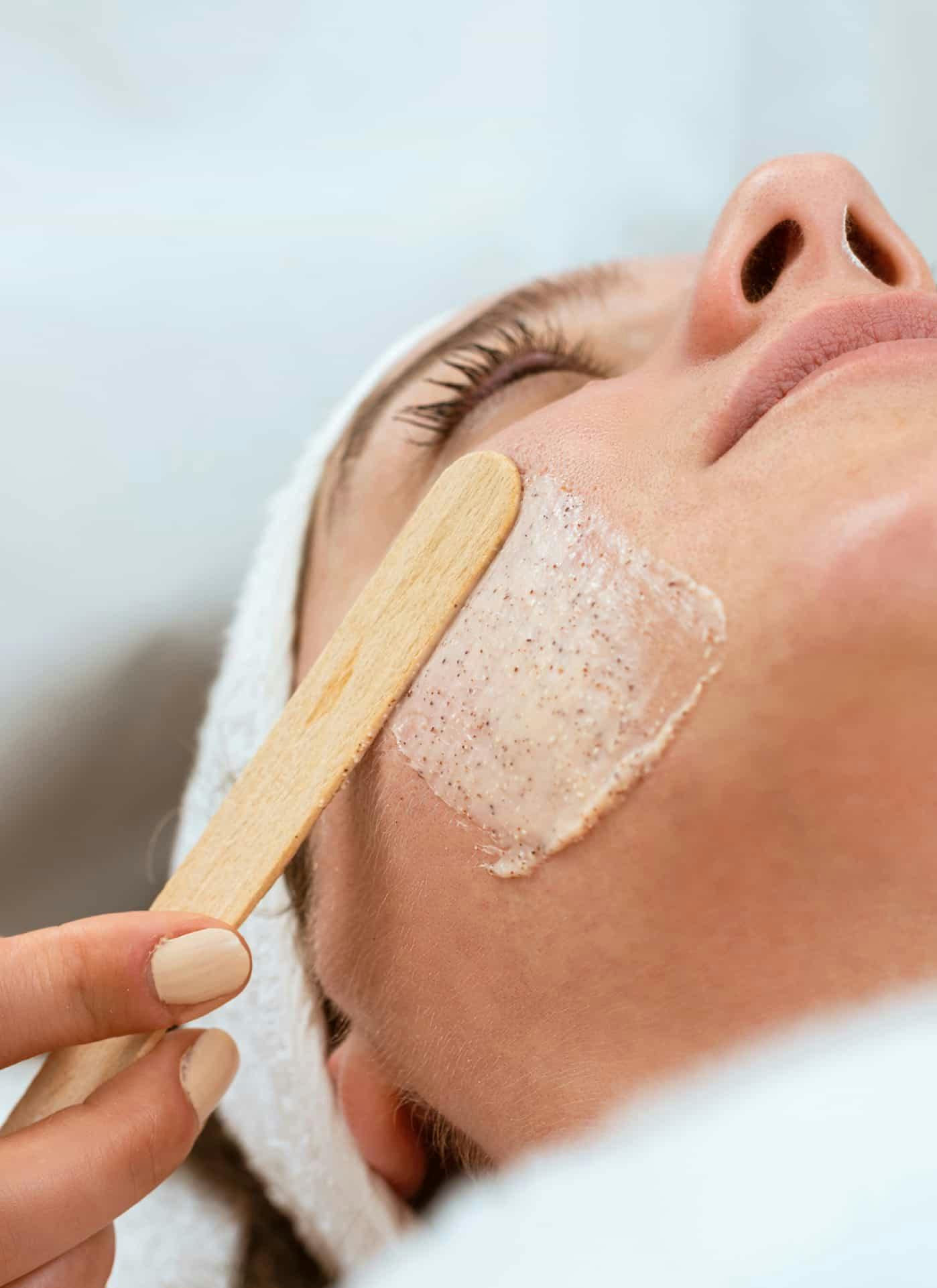 Patient during facial peel