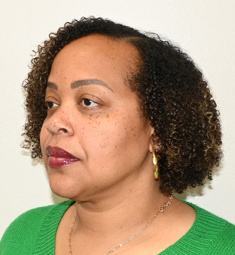 Liposuction Before & After Gallery - Patient 851166 - Image 8