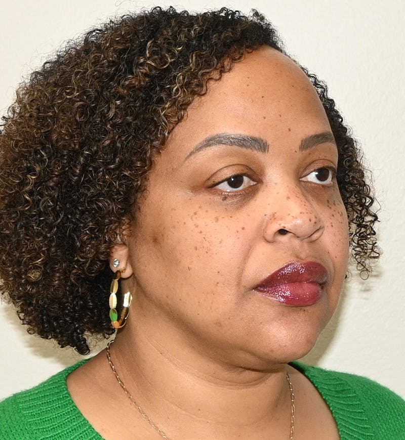 Liposuction Before & After Gallery - Patient 851166 - Image 4