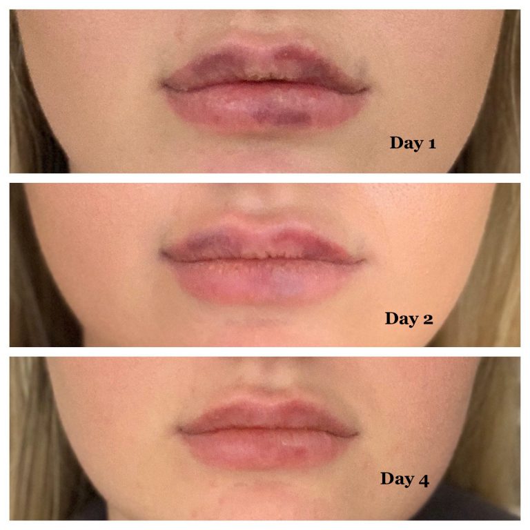 patient results