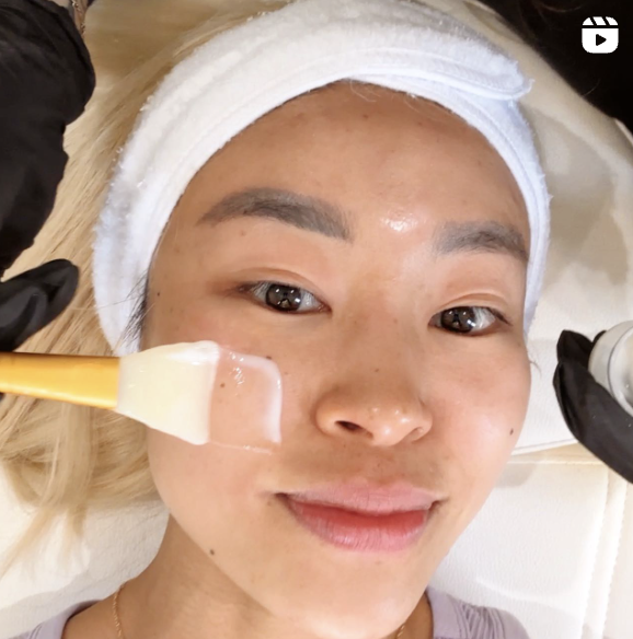 woman getting a facial