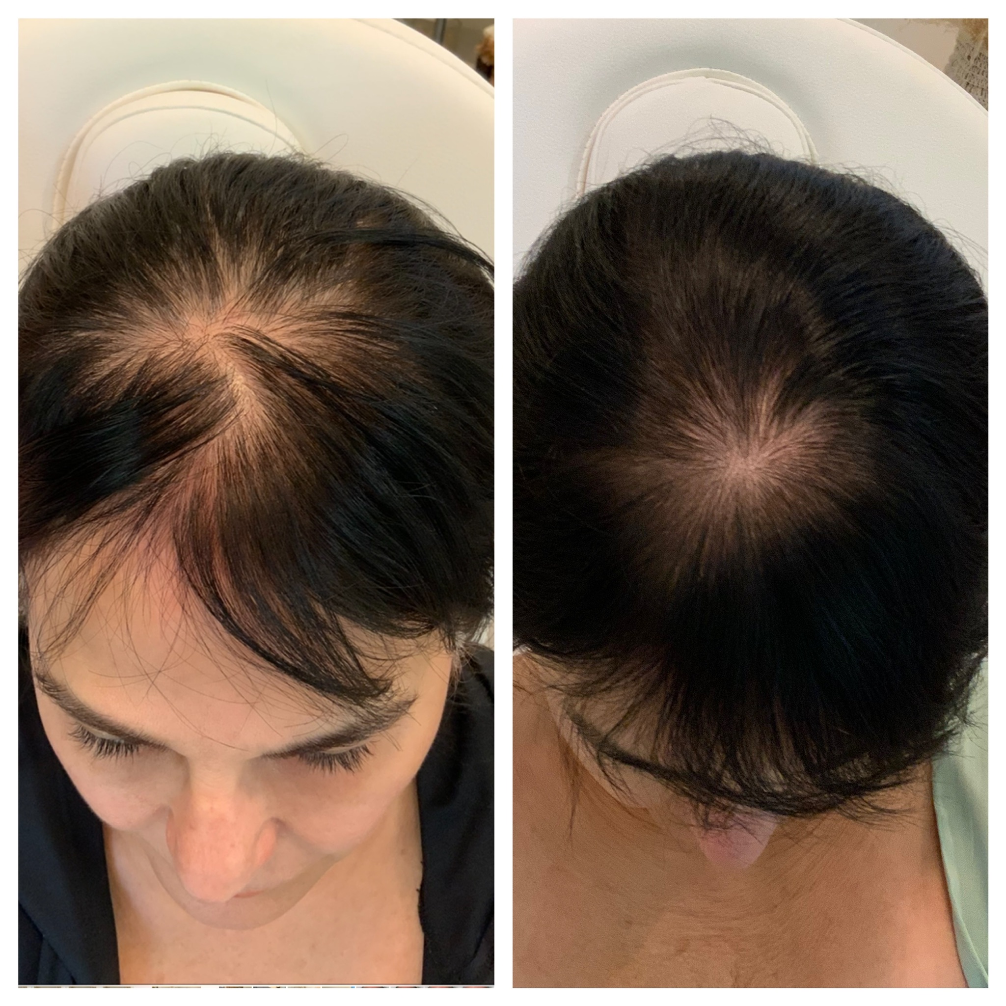 patient results