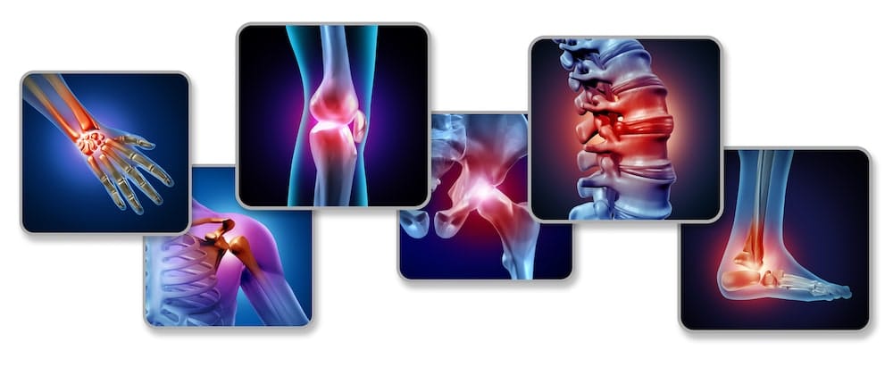 Illustrated graphic of joint pain in the hand, knee, spine, foot, and shoulder