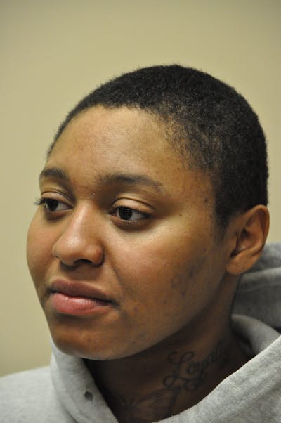 Functional Rhinoplasty Before & After Gallery - Patient 302925 - Image 1