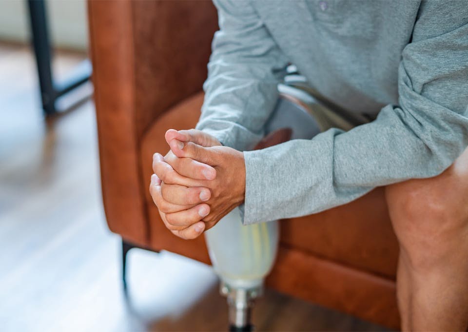 man with a prosthetic leg sitting on a couch
