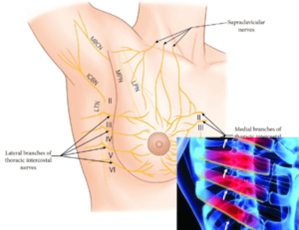 breast infographic