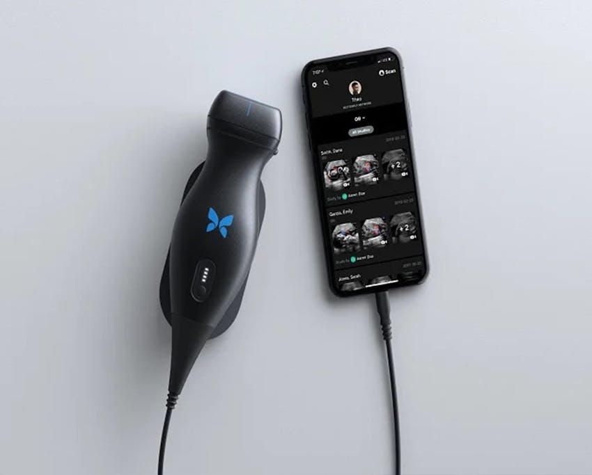 implant monitoring device