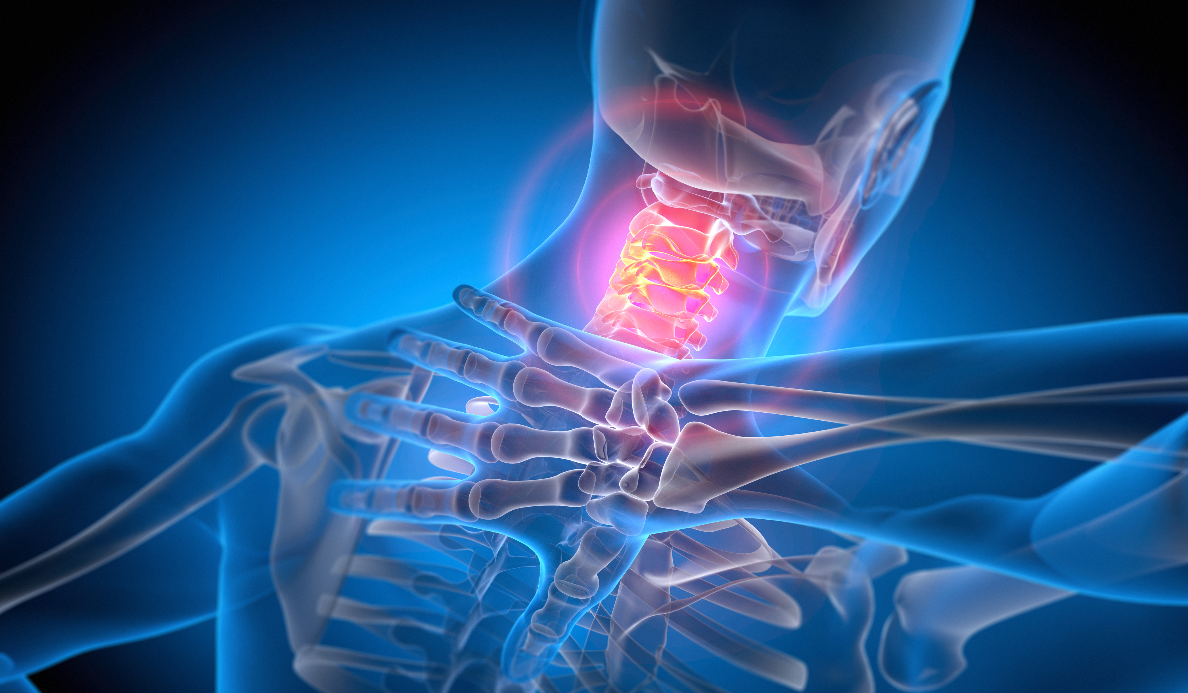 Neck Injury Attorney in Stamford, CT | Goff Law Group