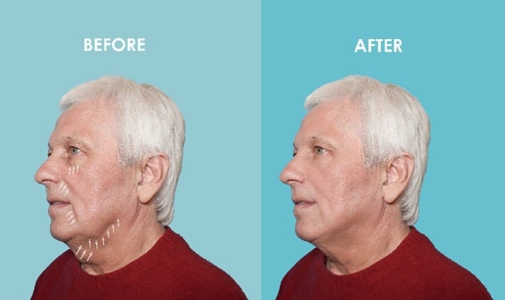 patient results