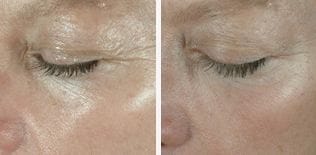 patient results