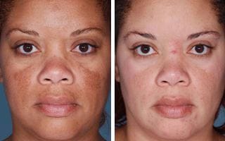 patient results