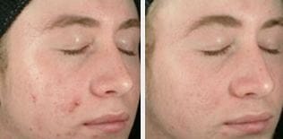 patient results