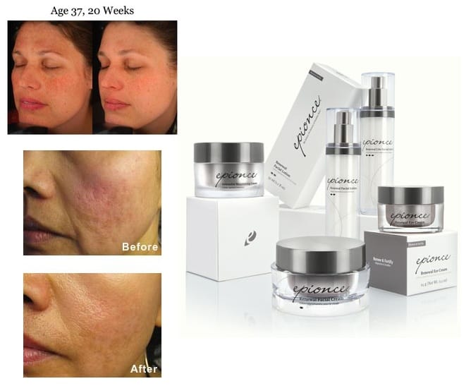 patient results