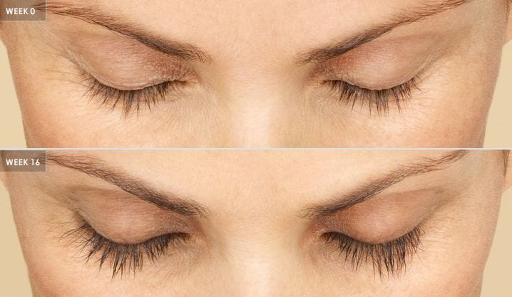 patient results