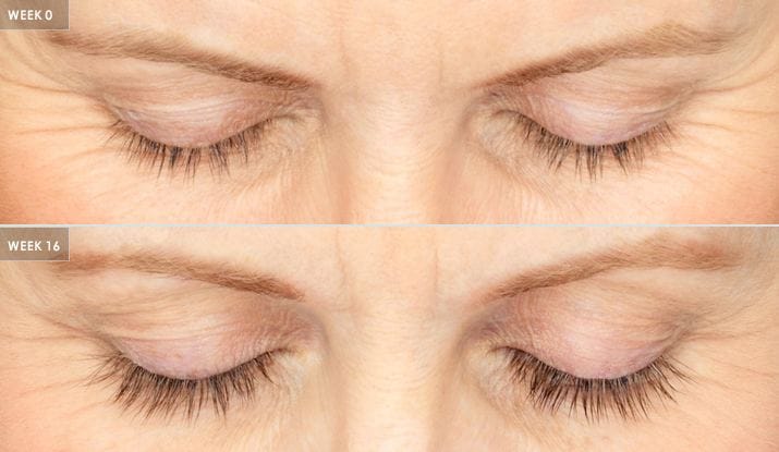 patient results