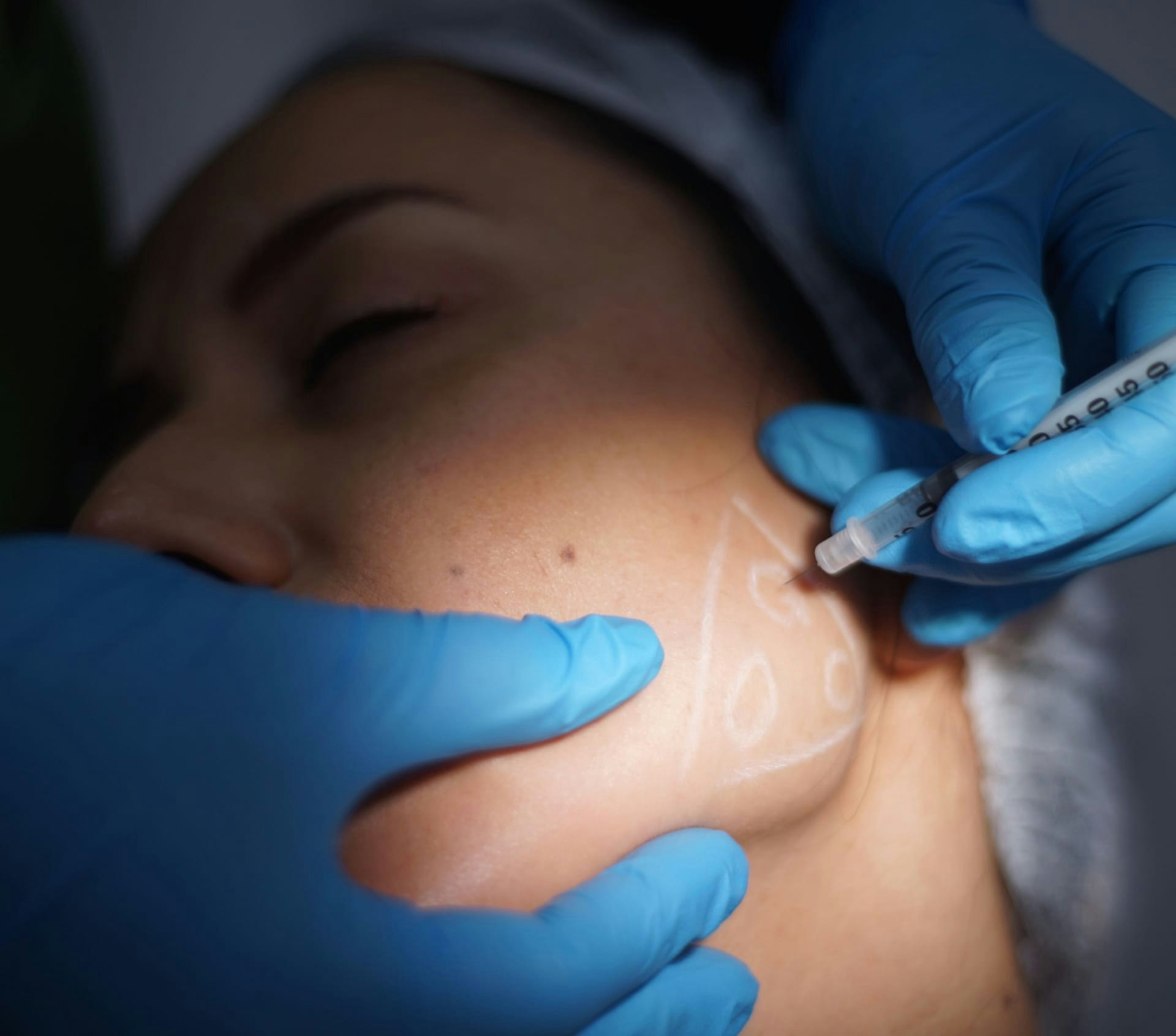doctor writing on a patient's face