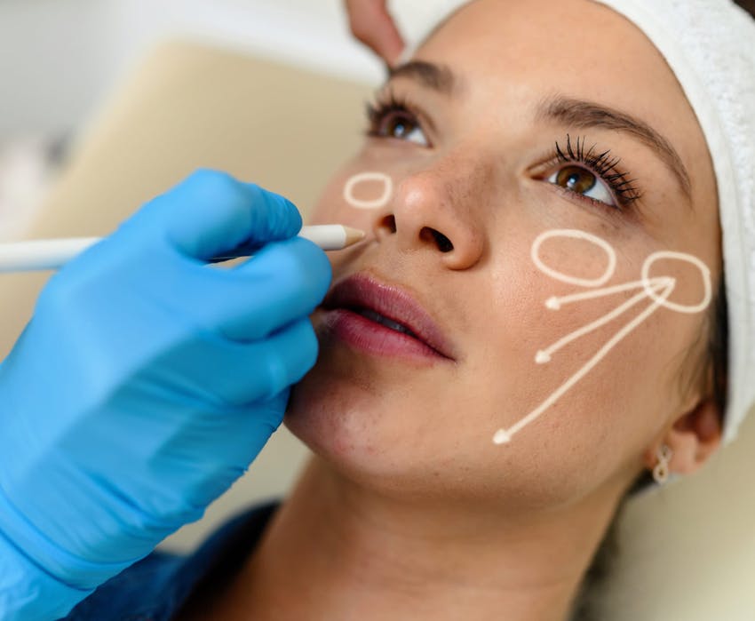 doctor drawing on a woman's face