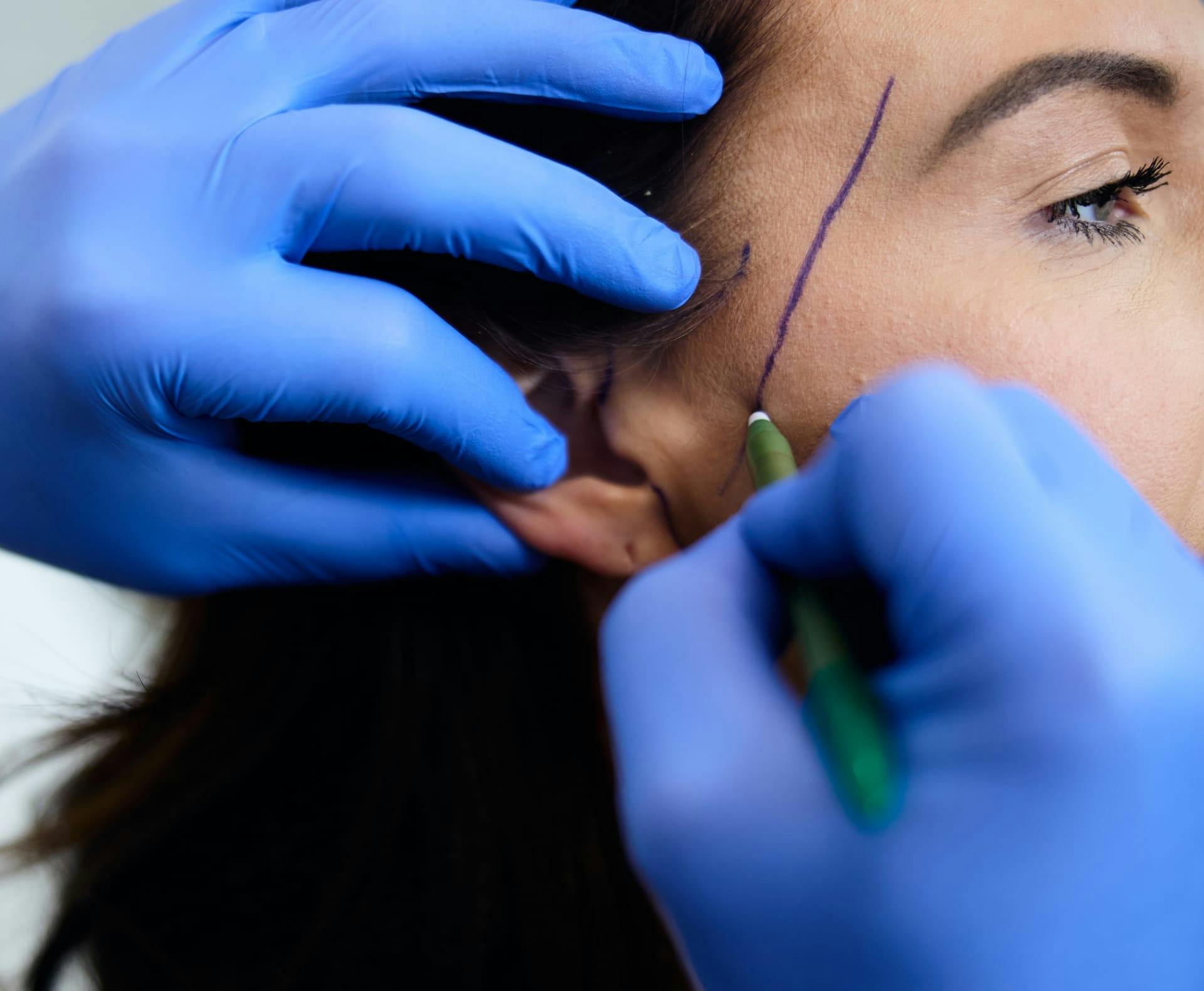 doctor drawing on a patient's face