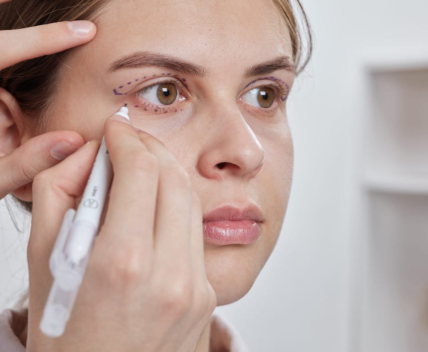 doctor marking a patient's face