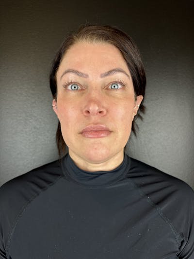 Comprehensive Treatment Plans Before & After Gallery - Patient 299186 - Image 2