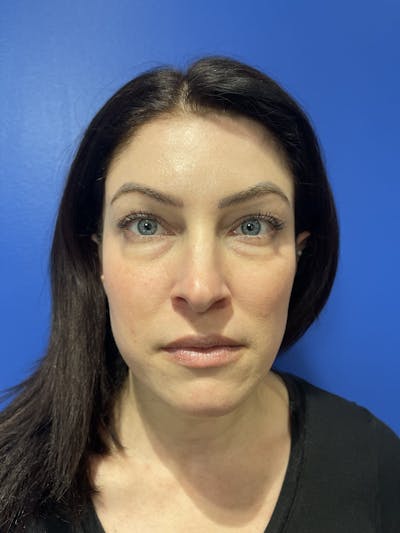 Comprehensive Treatment Plans Before & After Gallery - Patient 299186 - Image 1