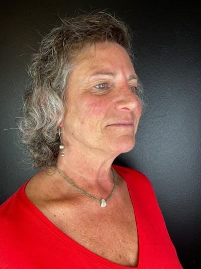 Comprehensive Treatment Plans Before & After Gallery - Patient 343538 - Image 1