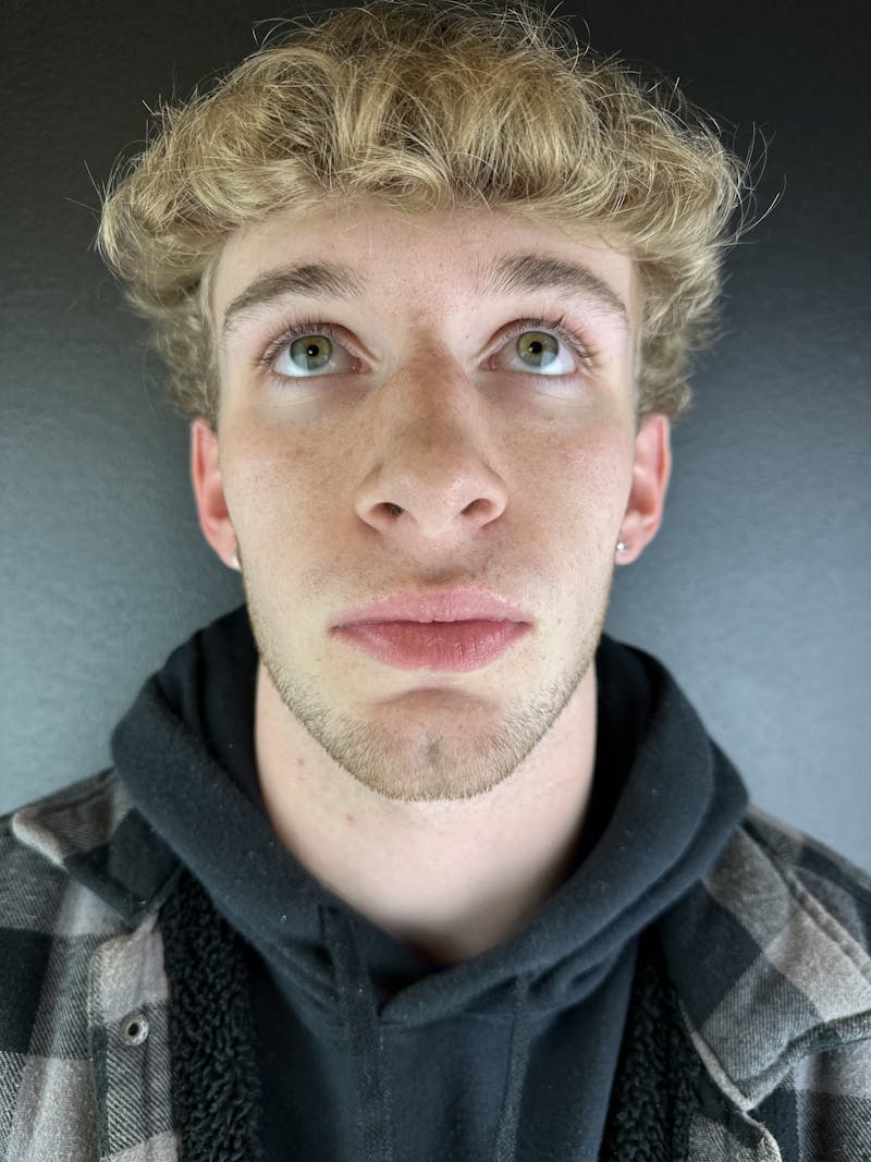 Chin Filler Before & After Gallery - Patient 496980 - Image 2