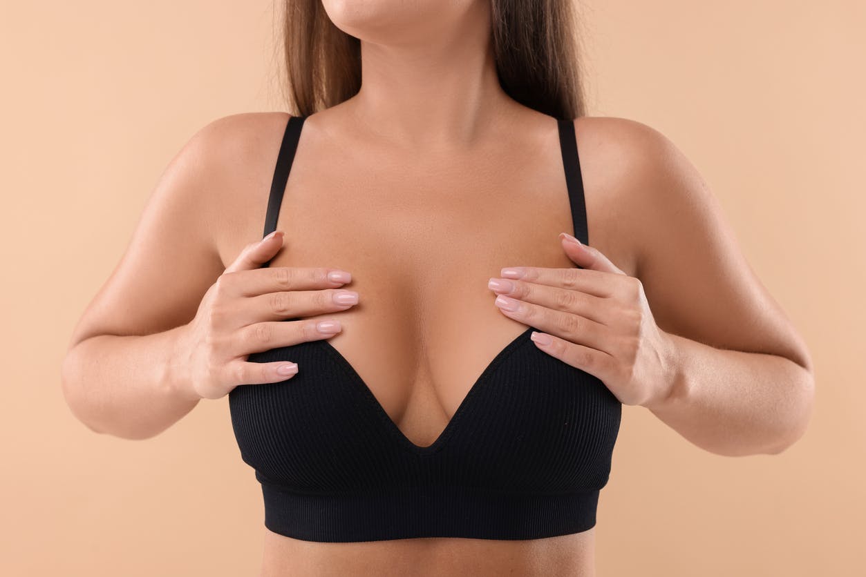 woman in black bra after breast lift