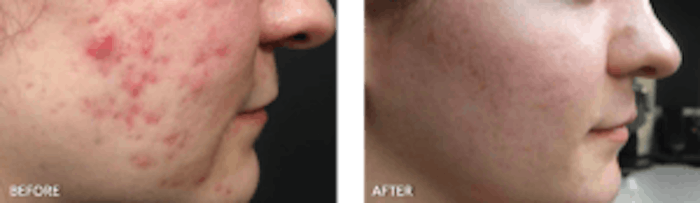 thumbs_DS-Before-After-Medical (1)