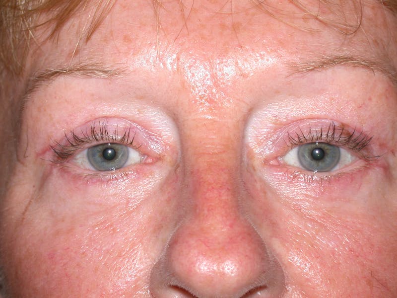 Cosmetic Surgeries Before & After Gallery - Patient 284921 - Image 2
