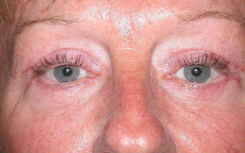 Cosmetic Surgeries Before & After Gallery - Patient 284921 - Image 2