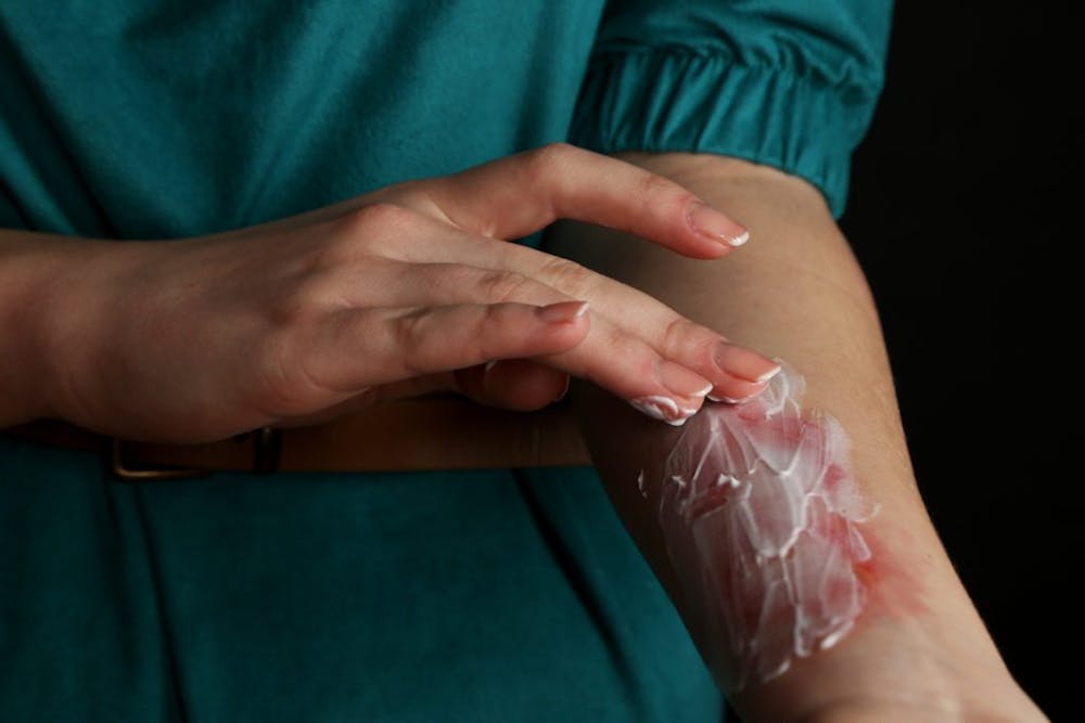 burn injury lawyer ventura ca burn injury lawyer ventura ca