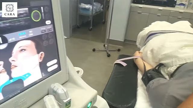ultherapy machine