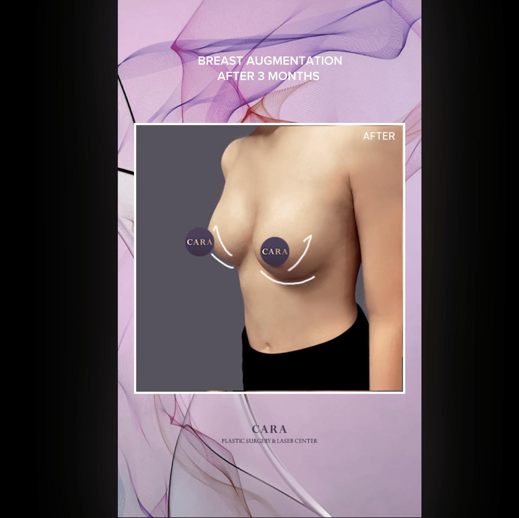 Cara Plastic Surgery & Laser Center