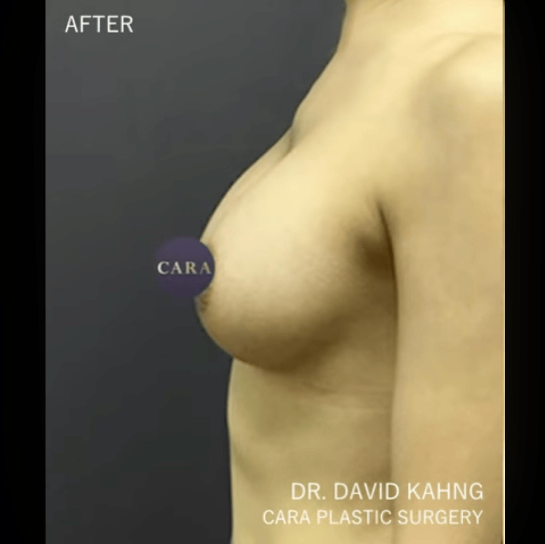 Cara Plastic Surgery & Laser Center