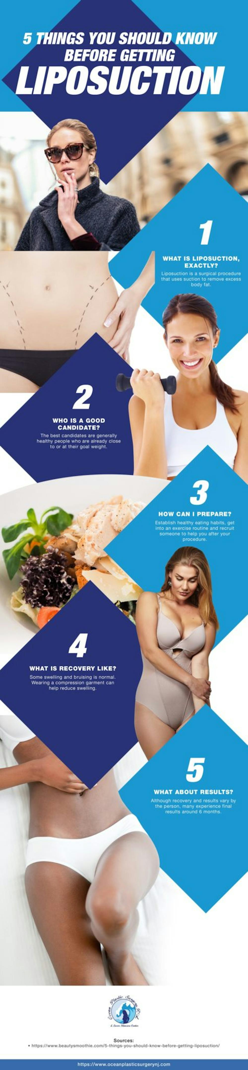 infographic