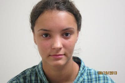 Otoplasty (Ear Tuck) Before & After Gallery - Patient 438859 - Image 2