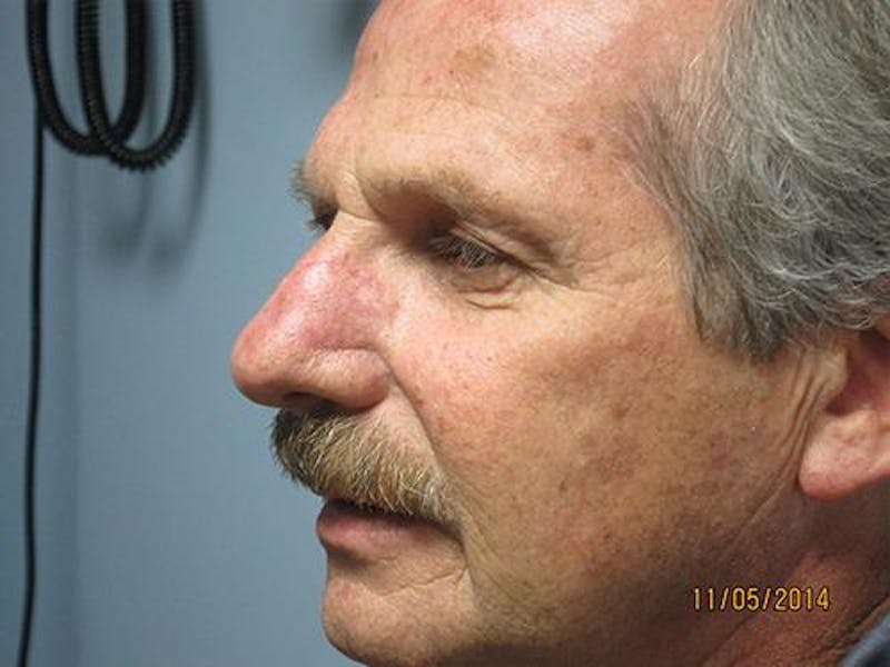 Face Reconstructive Before & After Gallery - Patient 521962 - Image 6
