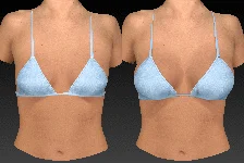 vectra xt imaging