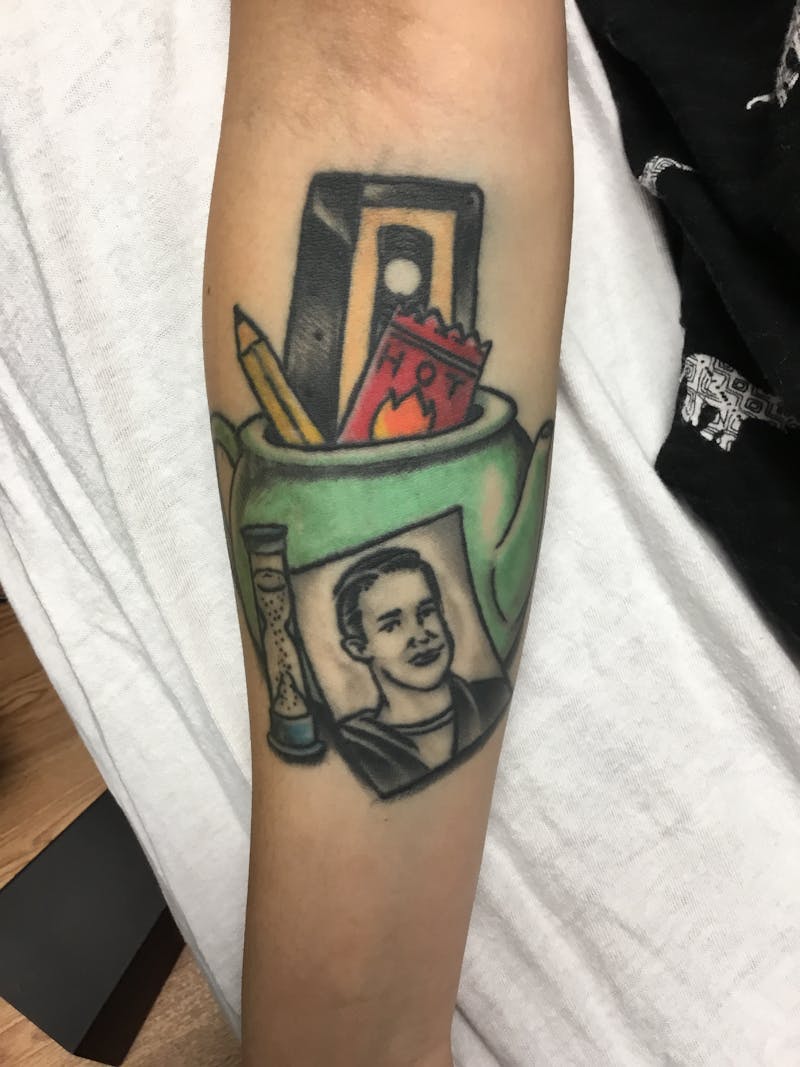 Tattoo Removal Before & After Gallery - Patient 139056 - Image 1