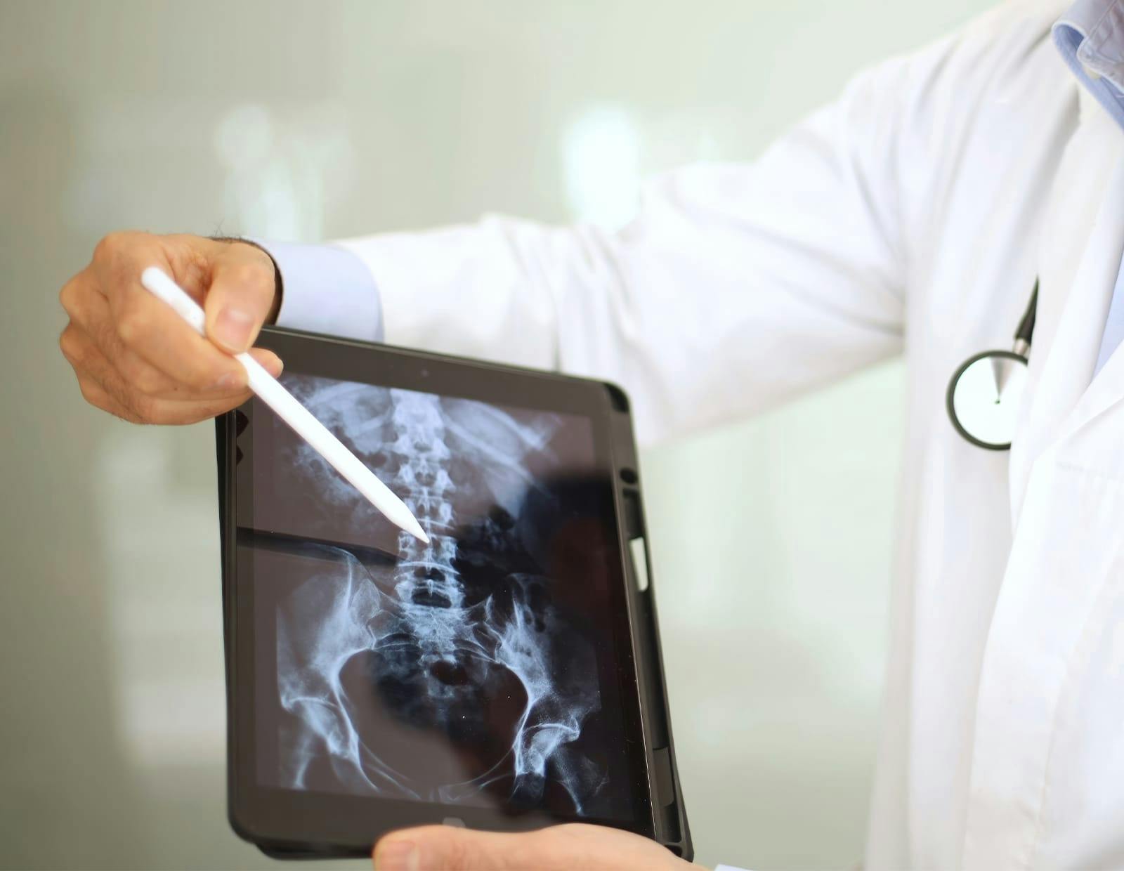 Medical professional pointing at a ipad with an spine X-ray