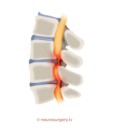 Neurosurgery.lv