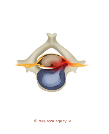 neurosurgery.lv